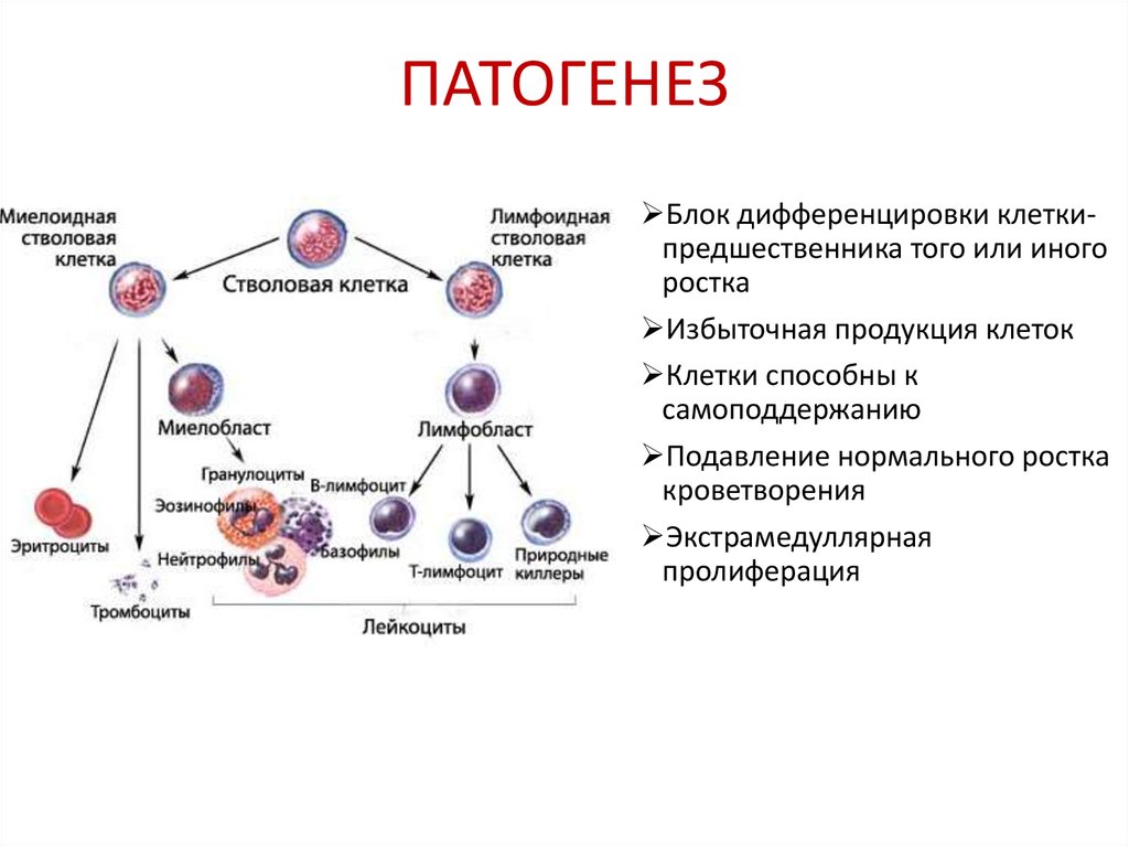 Патогенез лейкозов схема