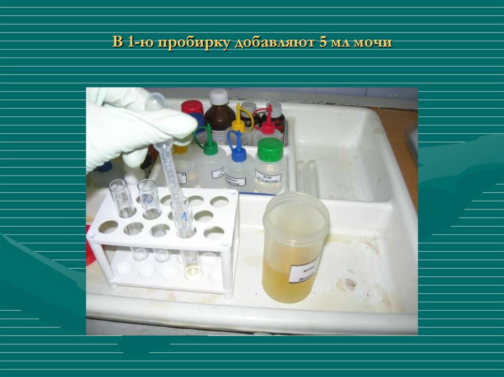 В одну пробирку добавьте. Биохимические основы технологии лекарственных форм. 5 Мл мочи. Добавляют в пробирку контр. Метод Нельсона.