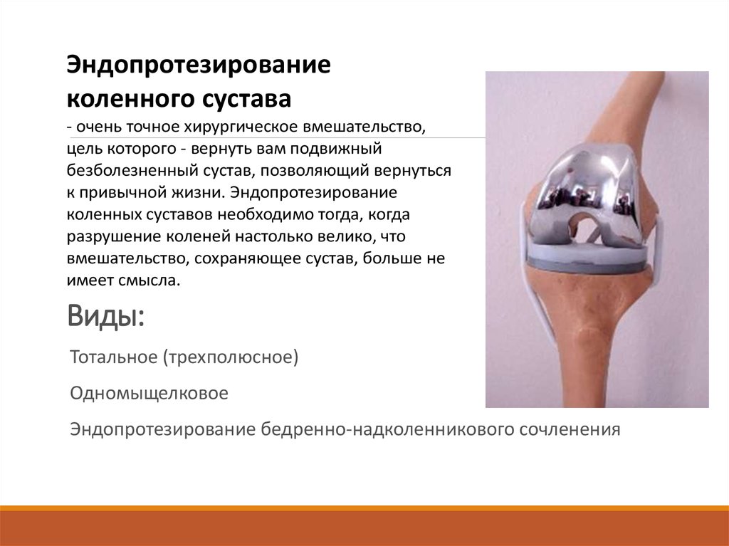 Чебоксары суставы операция. Искусственный протез коленного сустава. Одномыщелковое эндопротезирование коленного сустава. Эндопротез коленного сустава протокол операции. Тотальное цементное эндопротезирование коленного сустава.