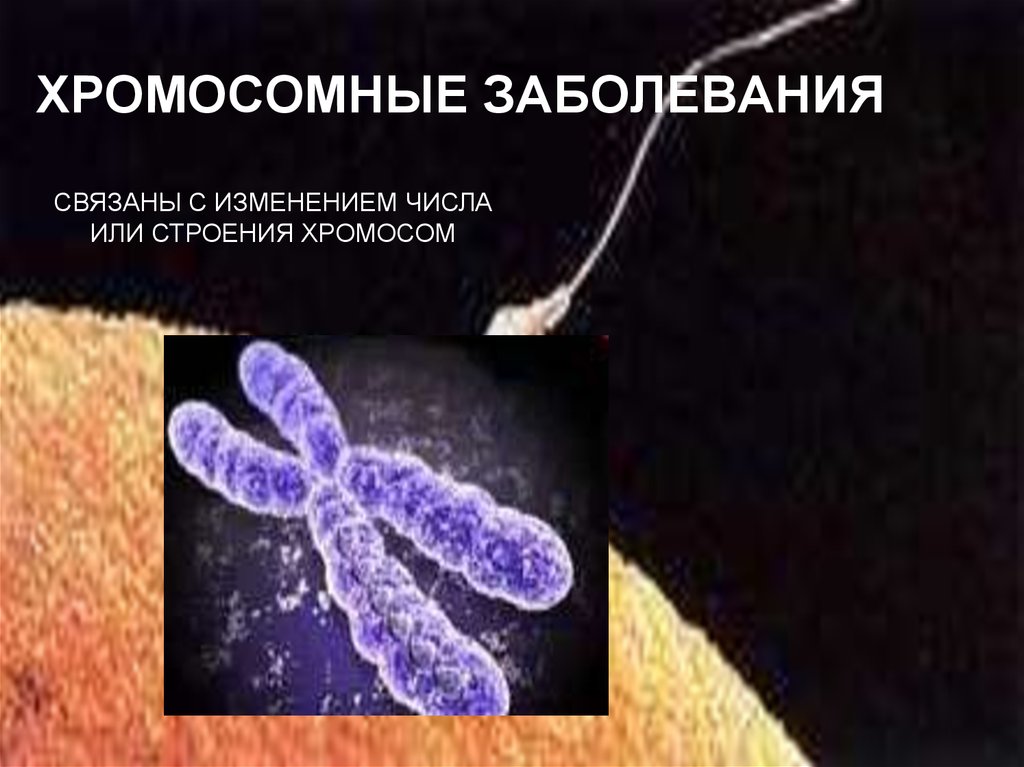 С изменением структуры хромосом связаны. Хромосомные болезни связанные с полом. Болезни связанные с полом. Болезни связанные с генетикой пола.
