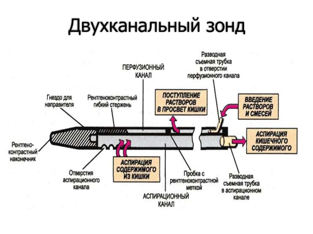 Зонд принцип