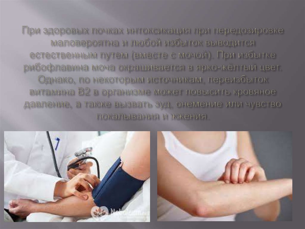 При здоровых почках интоксикация при передозировке маловероятна и любой избыток выводится естественным путем (вместе с мочой).