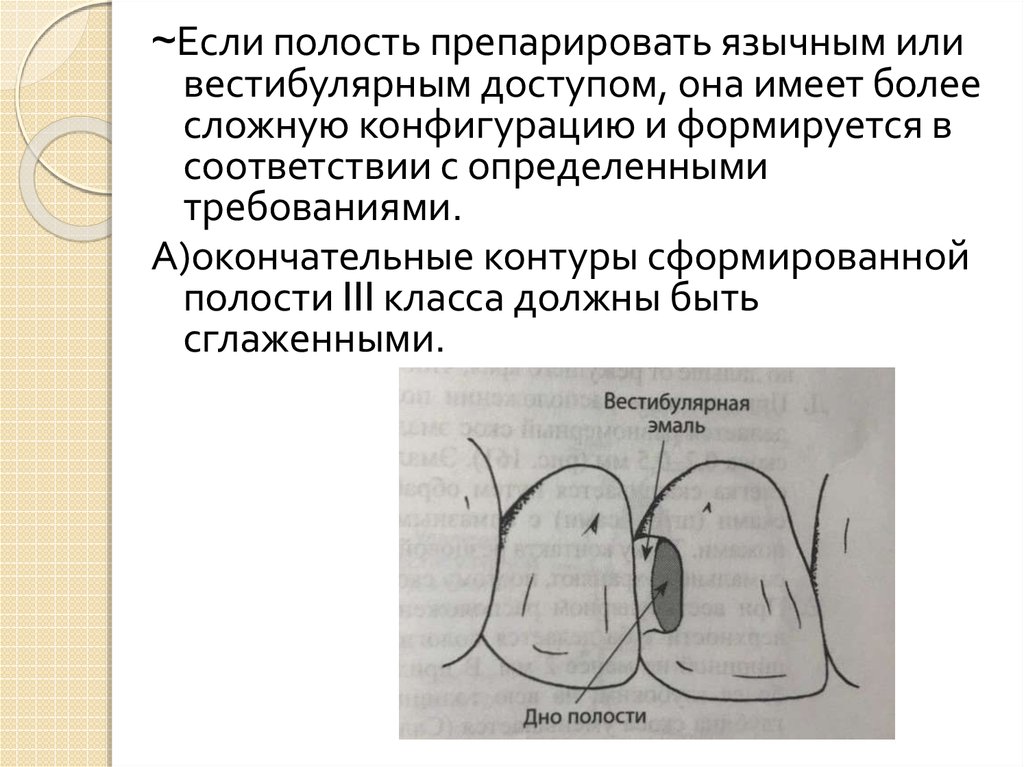 Кариозные полости 4 класса. Препарирование полости III класса по Блэку. Препарирование полостей IV класса по Блэку. Этапы препарирования кариозных полостей 3 класса по Блэку. Этапы препарирование кариозных полостей 3 и 4 класс по Блэку.