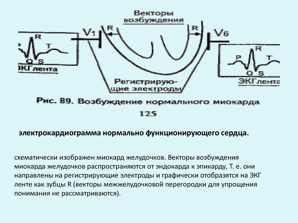 Диффузное нарушение процесса реполяризации