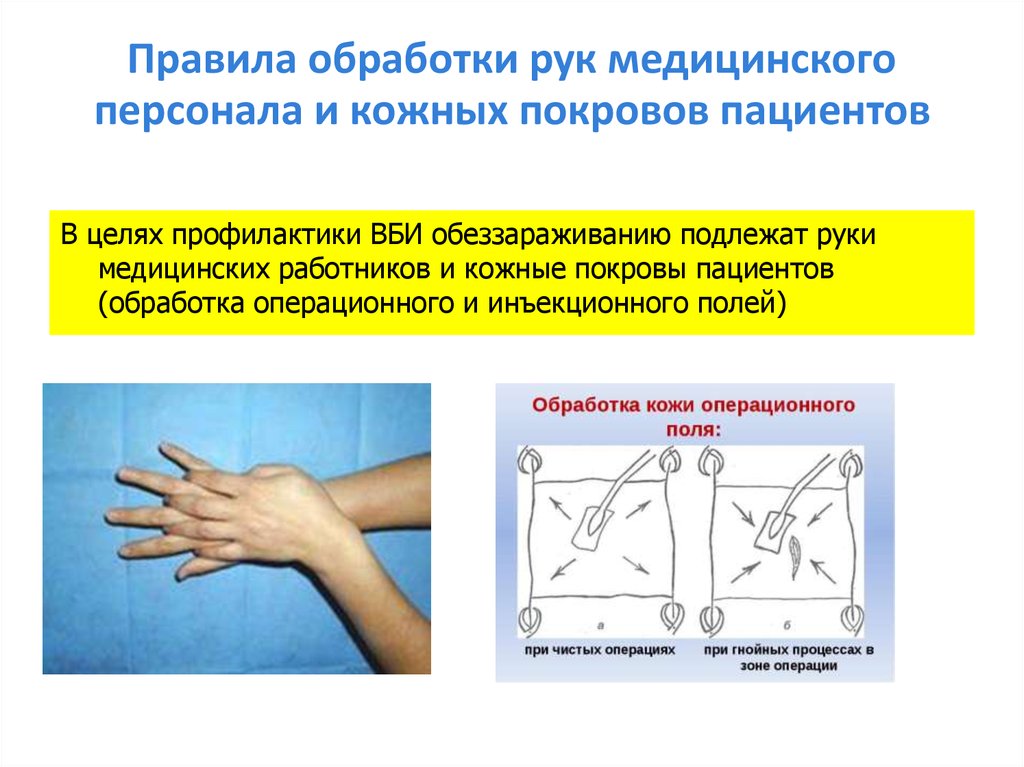 Цель хирургической обработки рук медперсонала