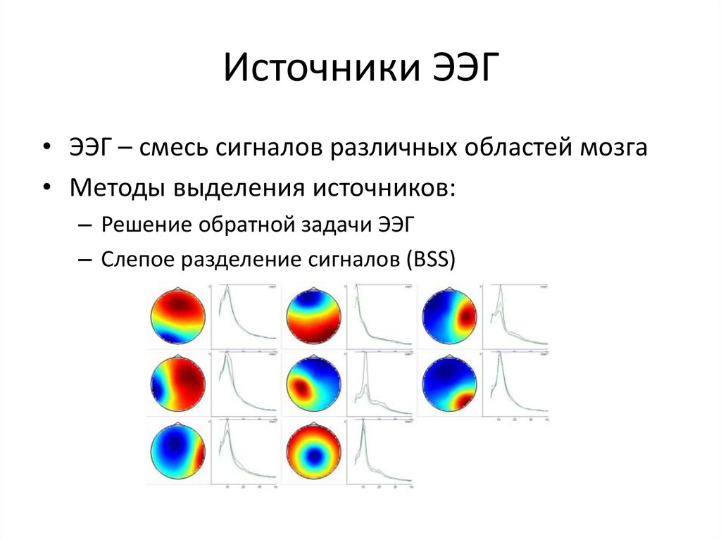 Источники ЭЭГ