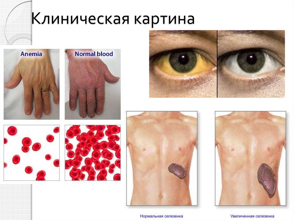 Клиническая картина