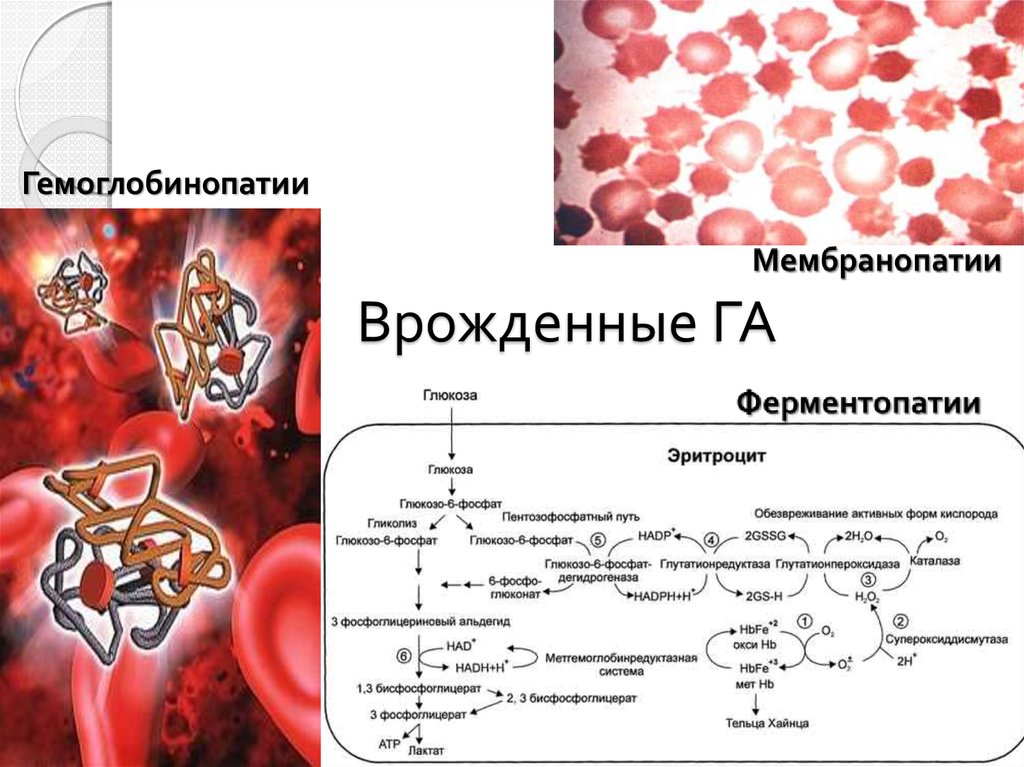 Презентация на тему гемоглобинопатия