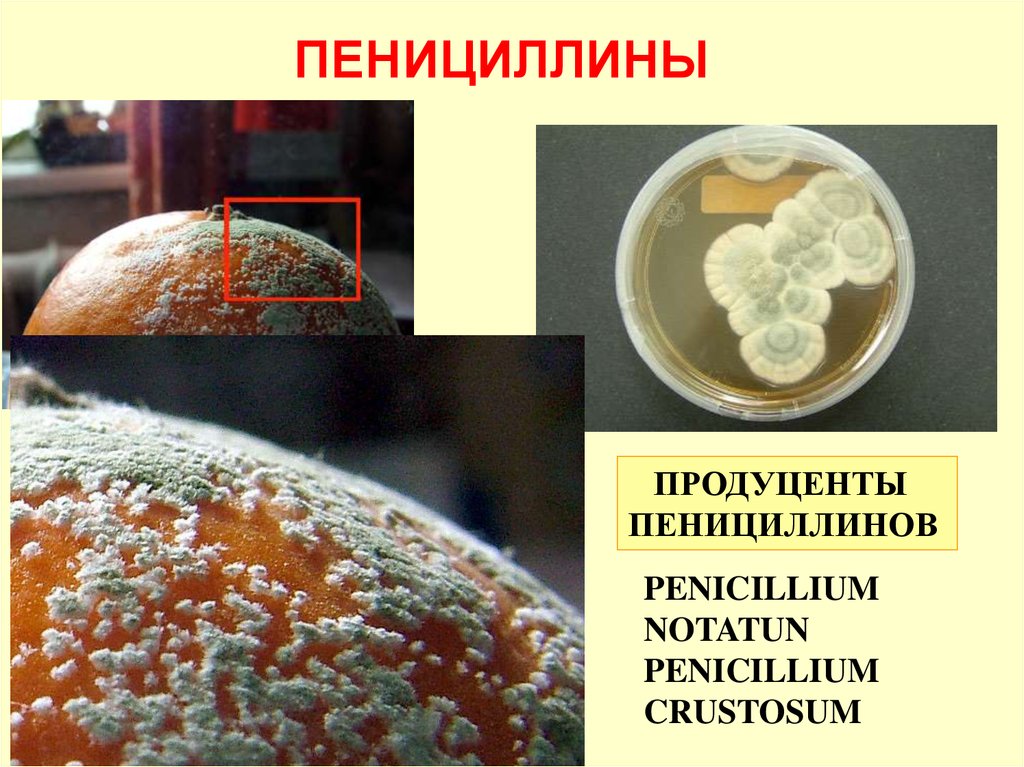 Продуцент пенициллина. Пенициллин история открытия. История открытия пеницилла. Открытие пенициллина кратко.