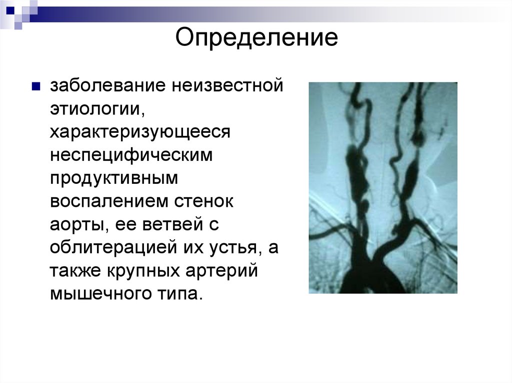 Артериит такаясу презентация