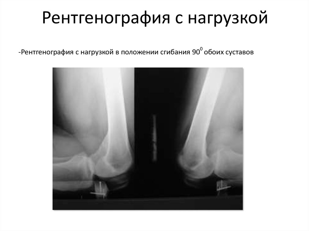 Рентгенография с прямым увеличением изображения применяется