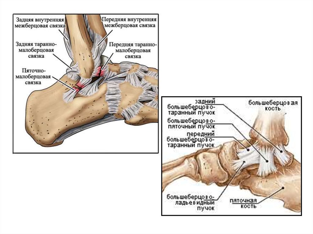 Повреждение малоберцовых связок. Задняя межберцовая связка голеностопного сустава. Задняя таранно-малоберцовая связка. Таранно пяточная связка. Задний отдел голеностопного сустава.