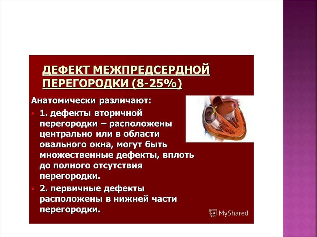 Дефект межпредсердной перегородки ответы нмо