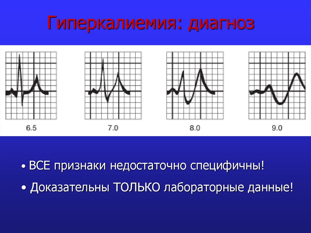 Гипокалиемия что это такое симптомы