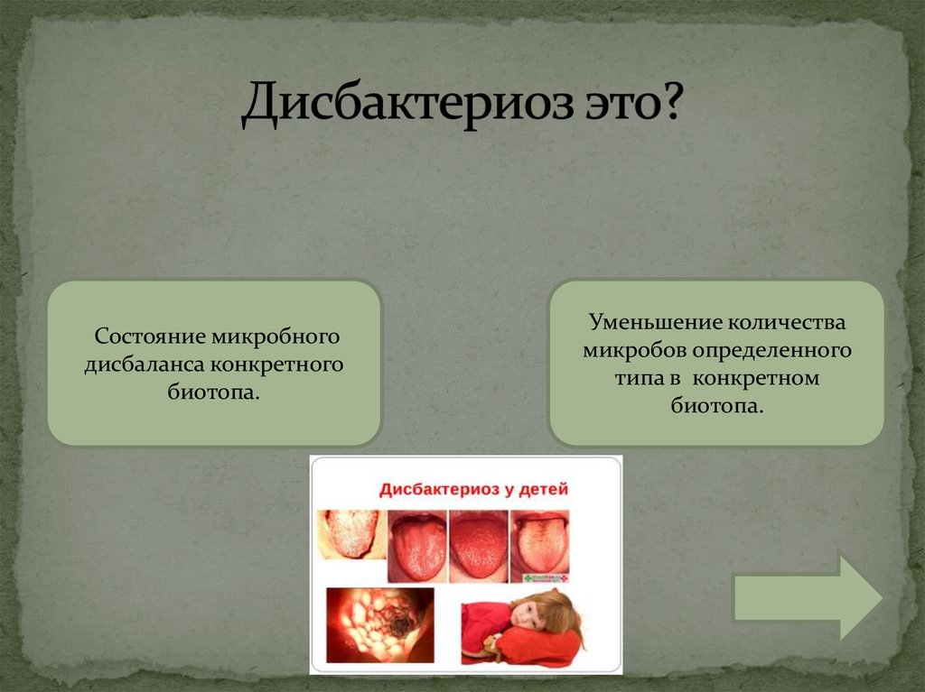 Дисбактериоз это. Дисбактериоз. Дисбактериоз презентация. Что такое дисбактериоз биология 8 класс. Дисбактериоз сообщение.