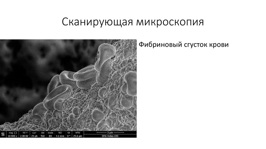 Сканирующая электронная микроскопия. Растровая (сканирующая) электронная микроскопия. Сканирующая электронная микроскопия микроскоп. Агрегированные порошки сканирующая микроскопия. Сканирующая электронная микроскопия изображение.