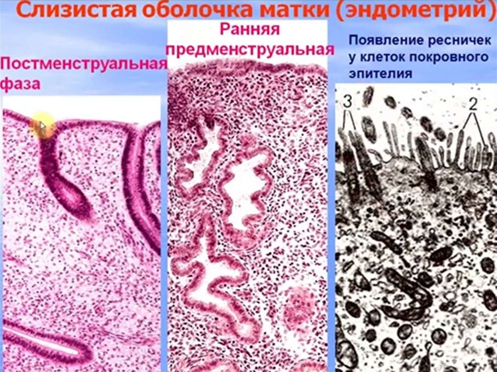 Оболочки матки. Матка предменструальный период препарат гистология. Слизистая оболочка матки гистология. Матка постменструальный период препарат гистология. Функции слизистой оболочки матки.