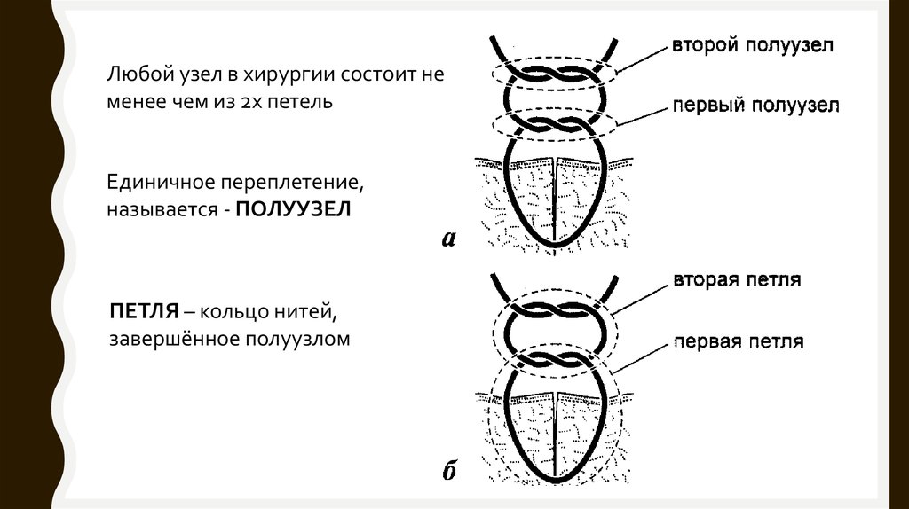 Состоит не менее чем из. Классификация узлов хирургия. Петли в хирургии. Узлы Оперативная хирургия. Хирургический узел состоит из полуузлов.