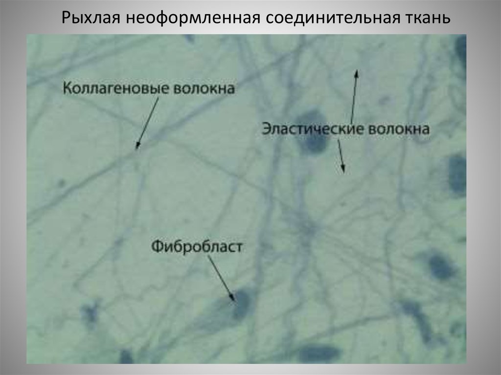 Рыхлая волокнистая соединительная ткань волокна. Рыхлая волокнистая неоформленная соединительная ткань препарат. Рыхлая соединительная ткань гистология препарат. Рыхлая волокнистая неоформленная соединительная ткань гистология. Рыхлая волокнистая соединительная ткань препарат.