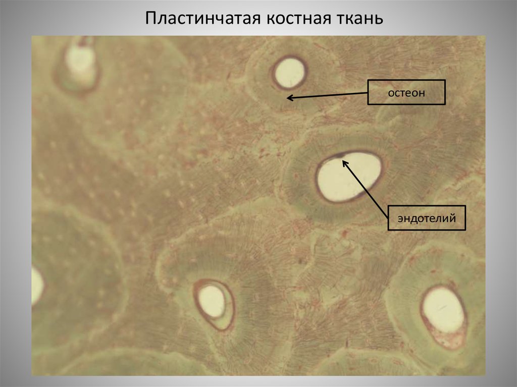 Рисунок костной ткани. Пластинчатая трабекулярная костная ткань. Пластинчатая костная ткань Электронограмма. Пластинчатая губчатая костная ткань. Остеон препарат гистология.