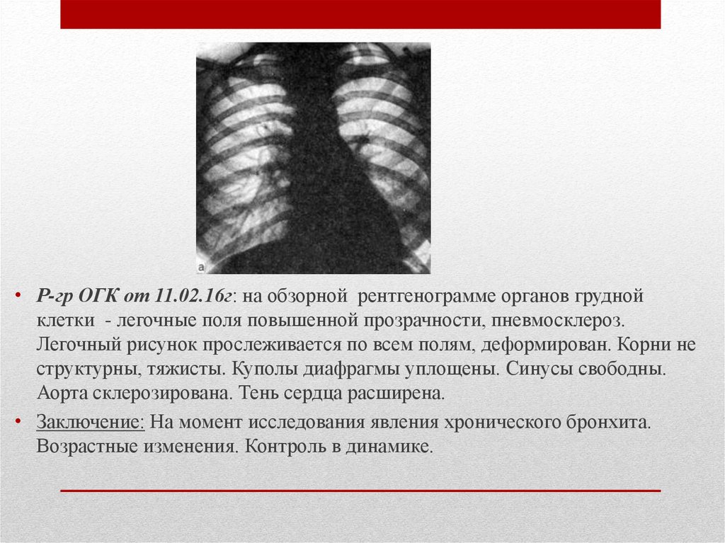 Корни тяжистые легких рисунок изменен