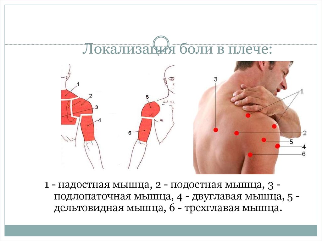 Сильно тянет левый. Дельтовидная мышца плеча болит. Локализация боли в плечевом. Болит левое плечо. Локализация боли в плече.
