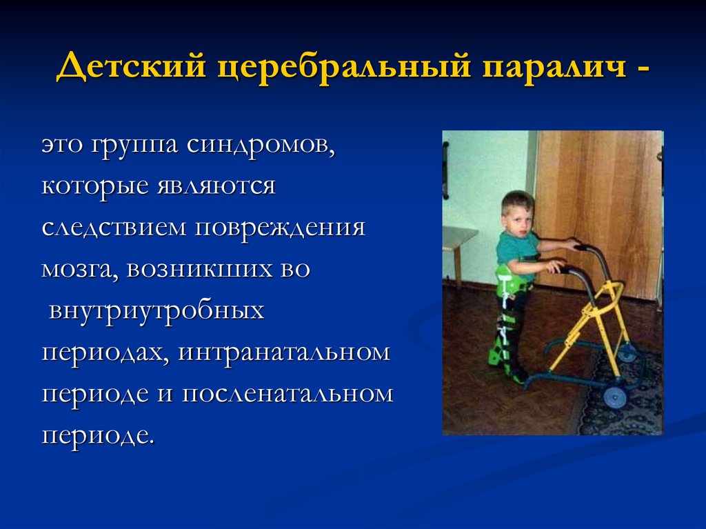 Инвалидность дети с рождения. Детский церебральный паралич. Дети с ДЦП. Детский церебральный парал. Детск церебрал паралич.