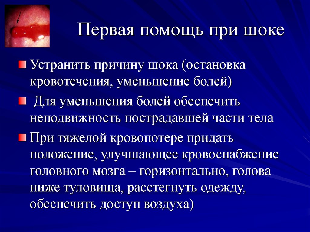 Первая медицинская помощь при анафилактическом шоке презентация