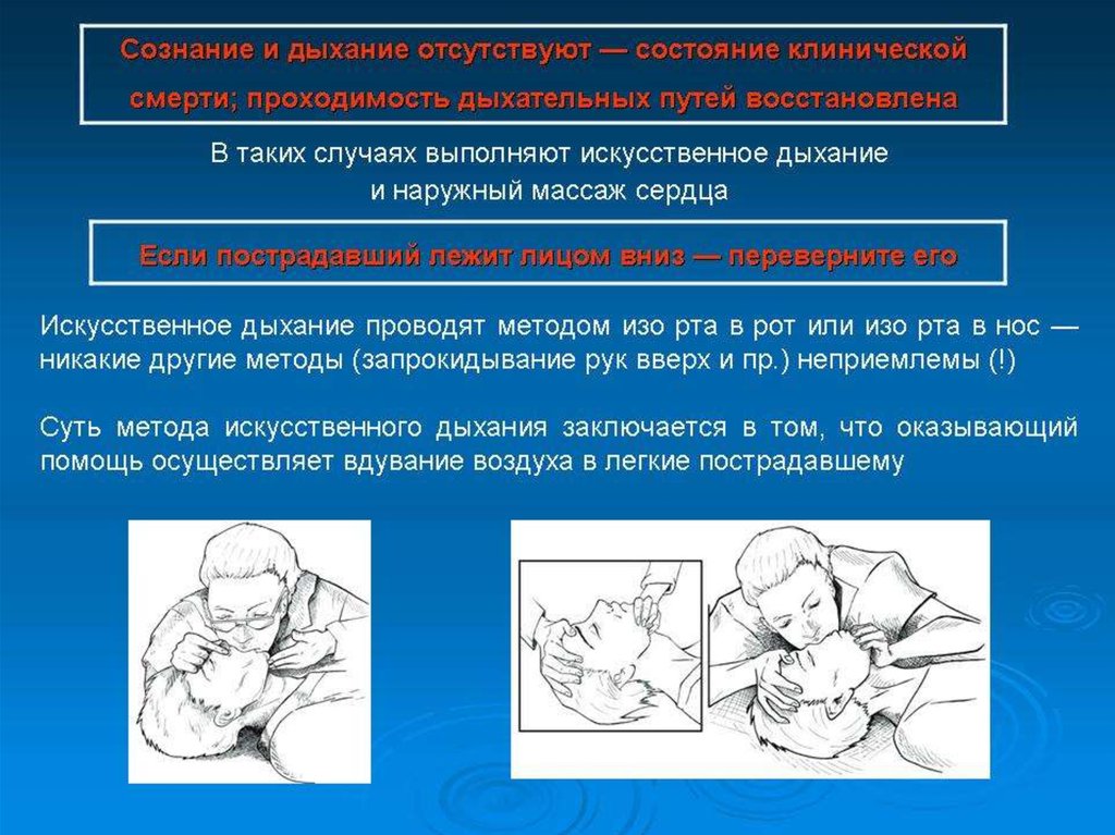 Сердечно легочная реанимация до появления признаков жизни. Сердечно сосудистая реанимация. Реанимация презентация. Легочно-сердечная реанимация презентация. Сердечно-легочная реанимация презентация.