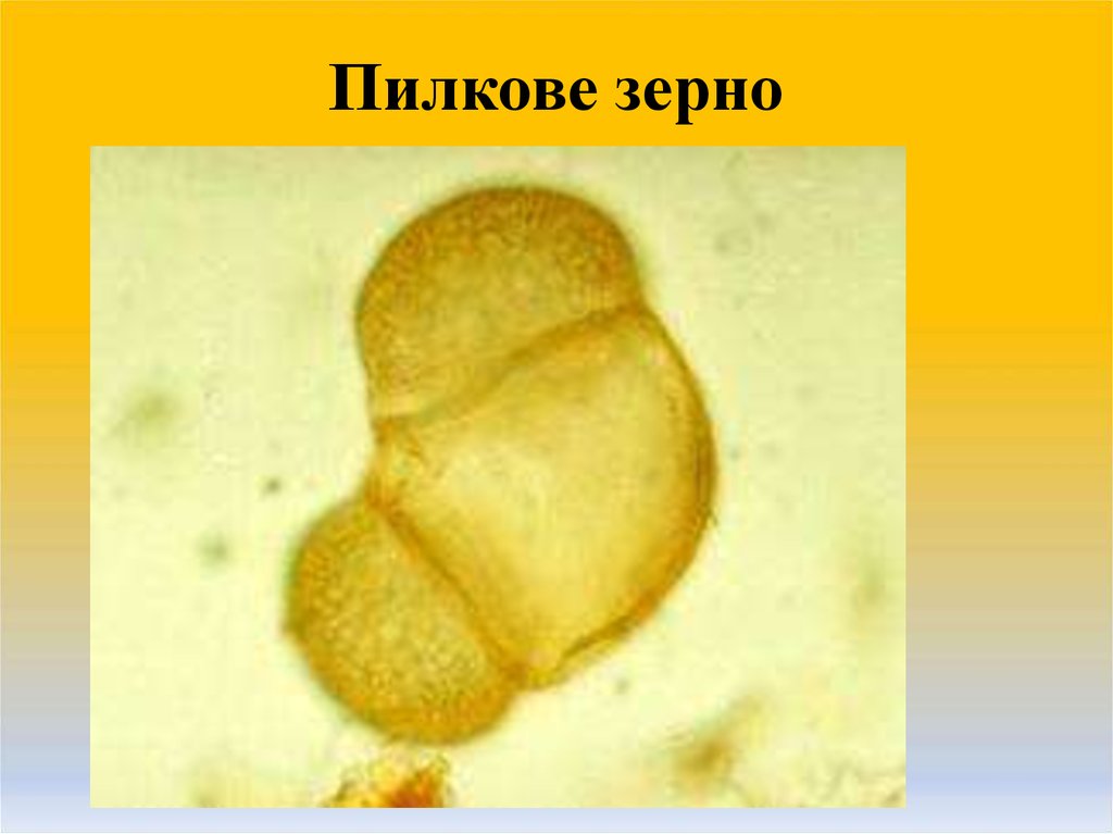 Пыльца с воздушными мешками. Микропрепарапыльца сосны. Пыльца сосны микропрепарат. Пыльца сосны микроскоп. Пыльца сосны под микроскопом.