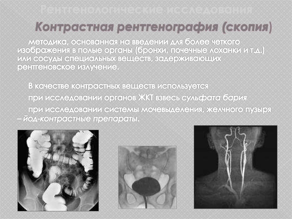 Контрастная рентгенография (скопия)