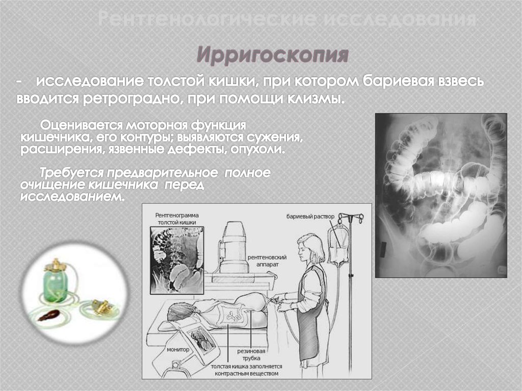 Ирригоскопия при хроническом гастрите подготовка