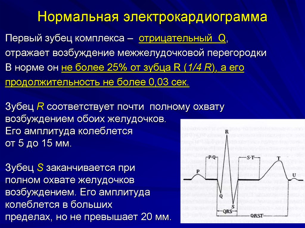 Комплекс нормально. ЭКГ сердца анатомия. Зубец r отражает возбуждение. Зубец r на ЭКГ отражает возбуждение. Электрокардиограмма с физической точки зрения представляет собой.