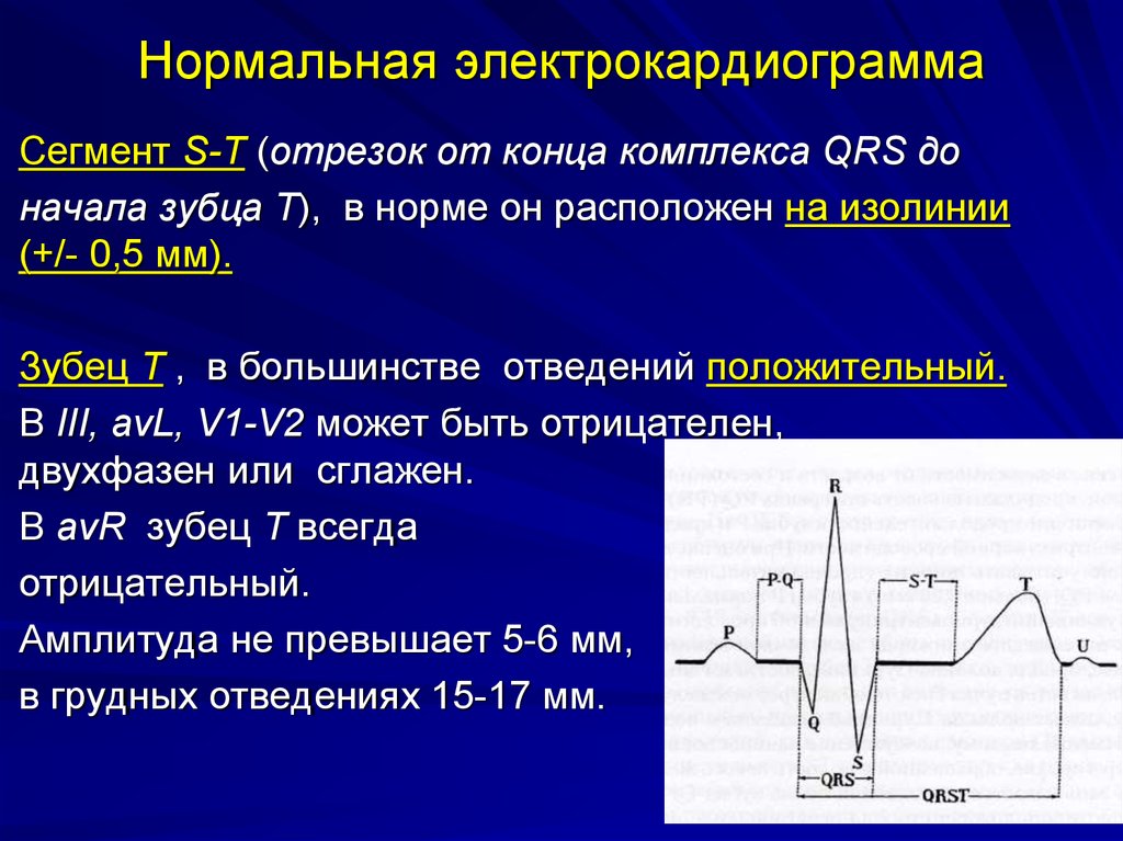 Отклонение qrs на экг что значит. Амплитуда комплекса QRS В норме. Вольтаж комплекса QRS. Комплекс QRS норма. QRS на ЭКГ.