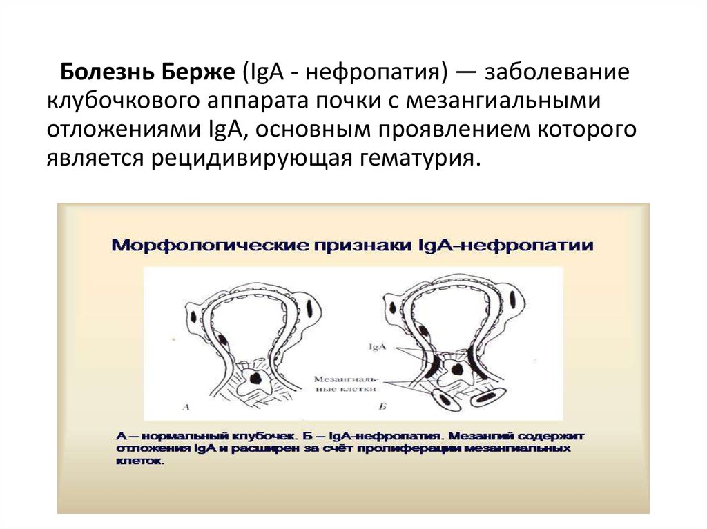 Берже болезнь презентация