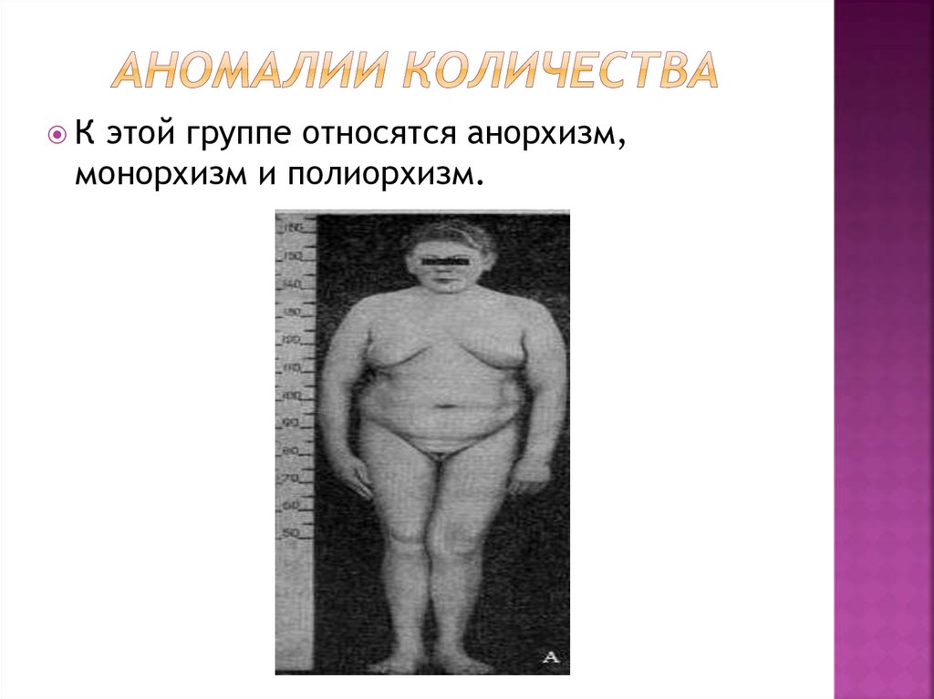 Аномалии количества