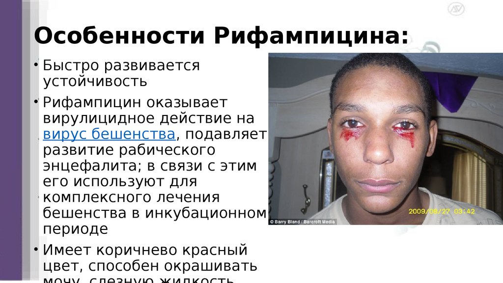 Особенности Рифампицина: