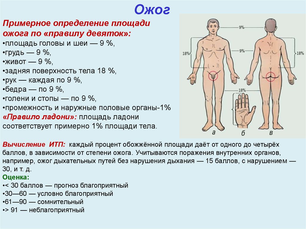 Площадь поражения при ожогах. Оценка площади ожога проводится по схеме. Площадь ожогаэт.