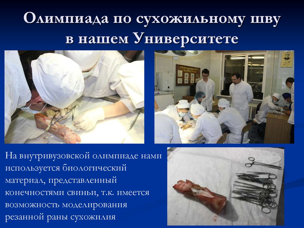 Олимпиада по сухожильному шву в нашем Университете
