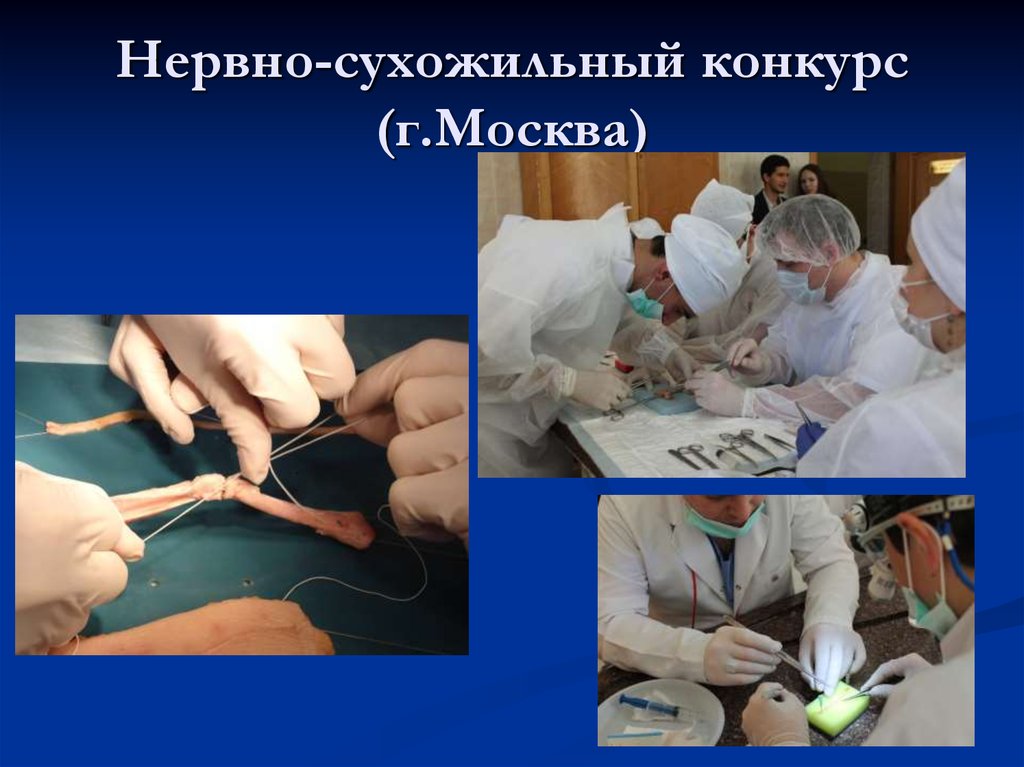 Нервно-сухожильный конкурс (г.Москва)