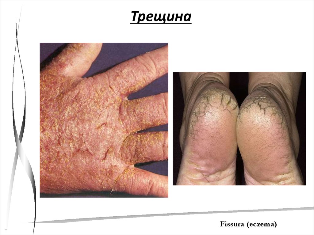 20 кожных заболеваний - презентация онлайн