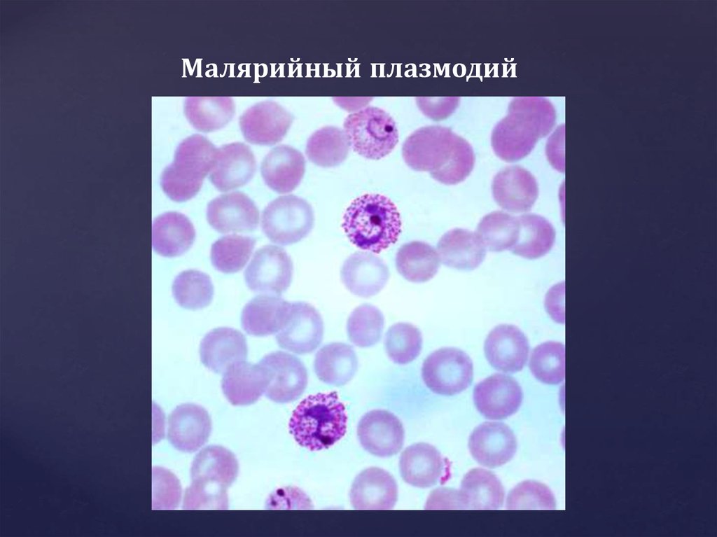 Малярия клетки. Малярийный плазмодий. Малярийный плазмодий препарат. Плазмодии малярии. Малярийный плазмодий в эритроцитах крови.