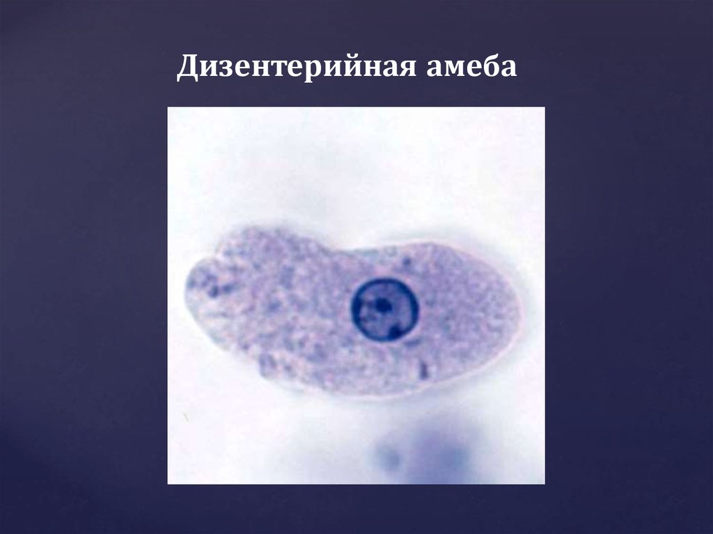 Заболевания вызванные амебами. Дизентерийная амеба (Entamoeba histolytica). Циста дизентерийной амебы. Дизентерийная амеба препарат. Дизентерийная амеба микропрепарат.