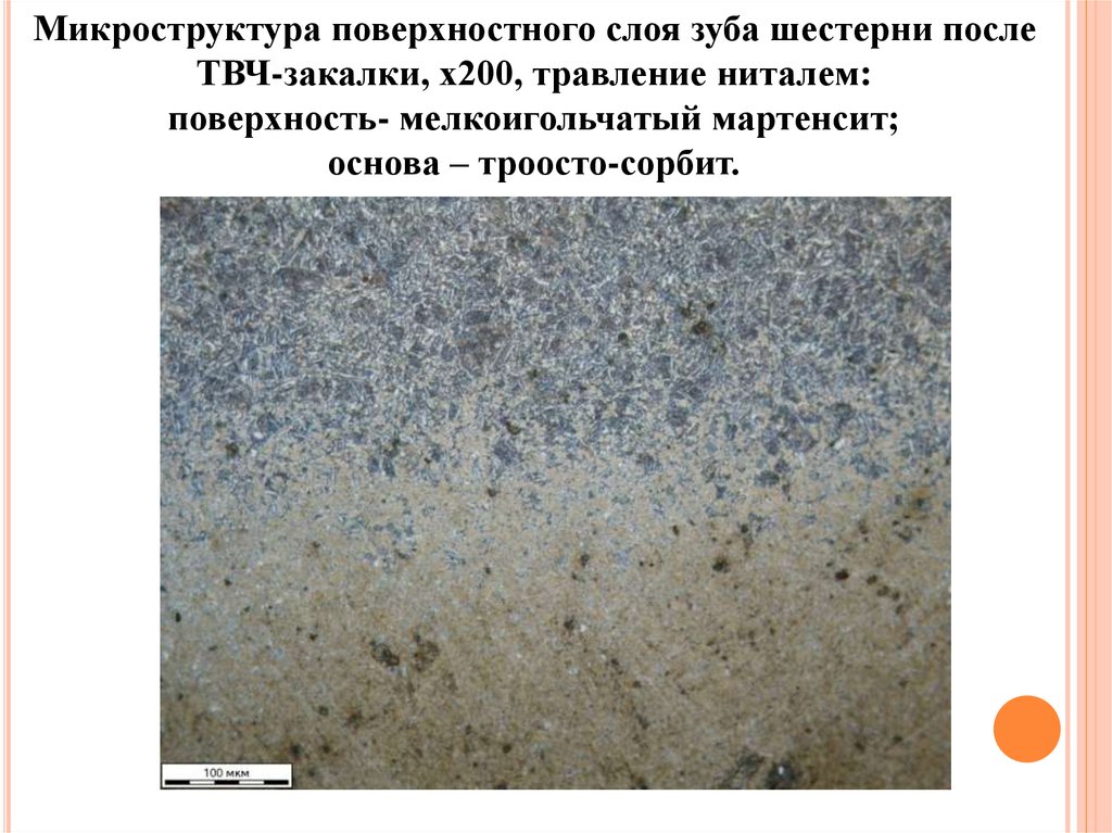 Поверхностное упрочнение. Сталь 40 микроструктура. Микроструктура после закалки ТВЧ. Микроструктура стали после ТВЧ закалки. Структура закалки.