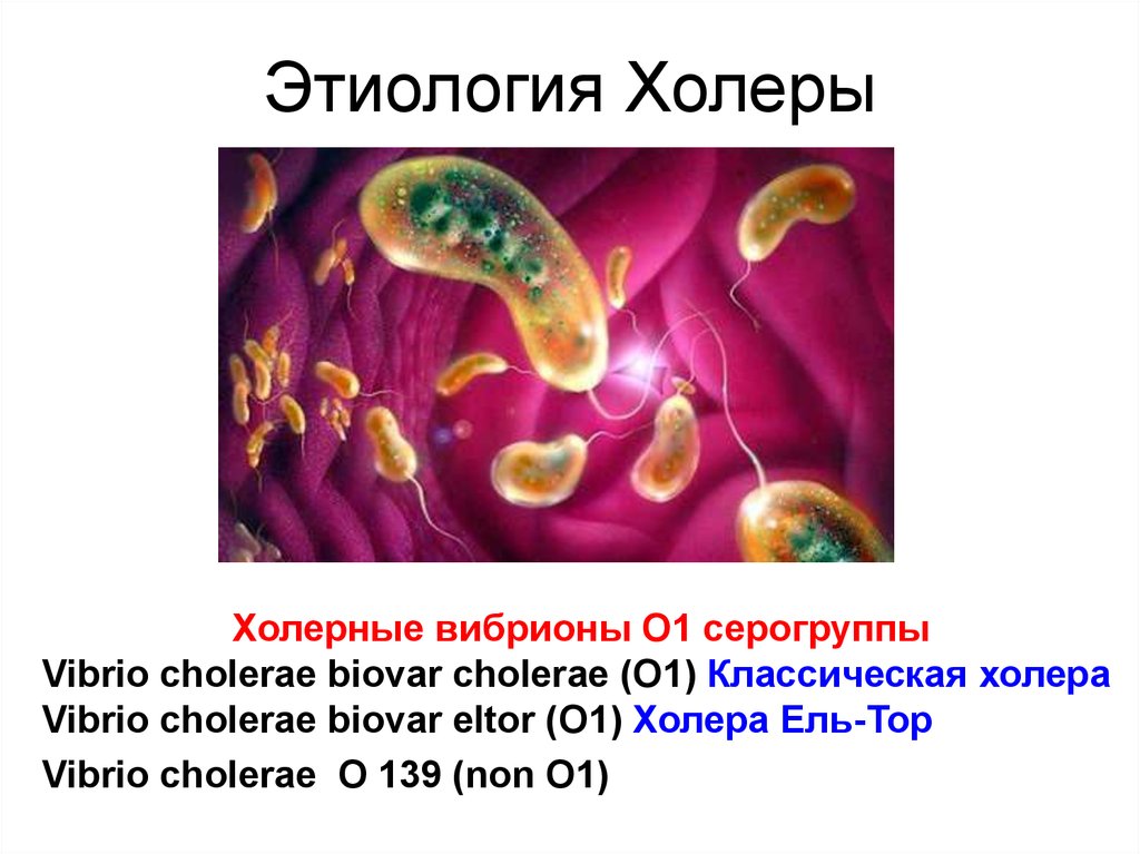 Холера имеет. Холерный вибрион этиология. Классификация вибрионов холеры. Холера этиология возбудителя. Вибрион холеры строение.