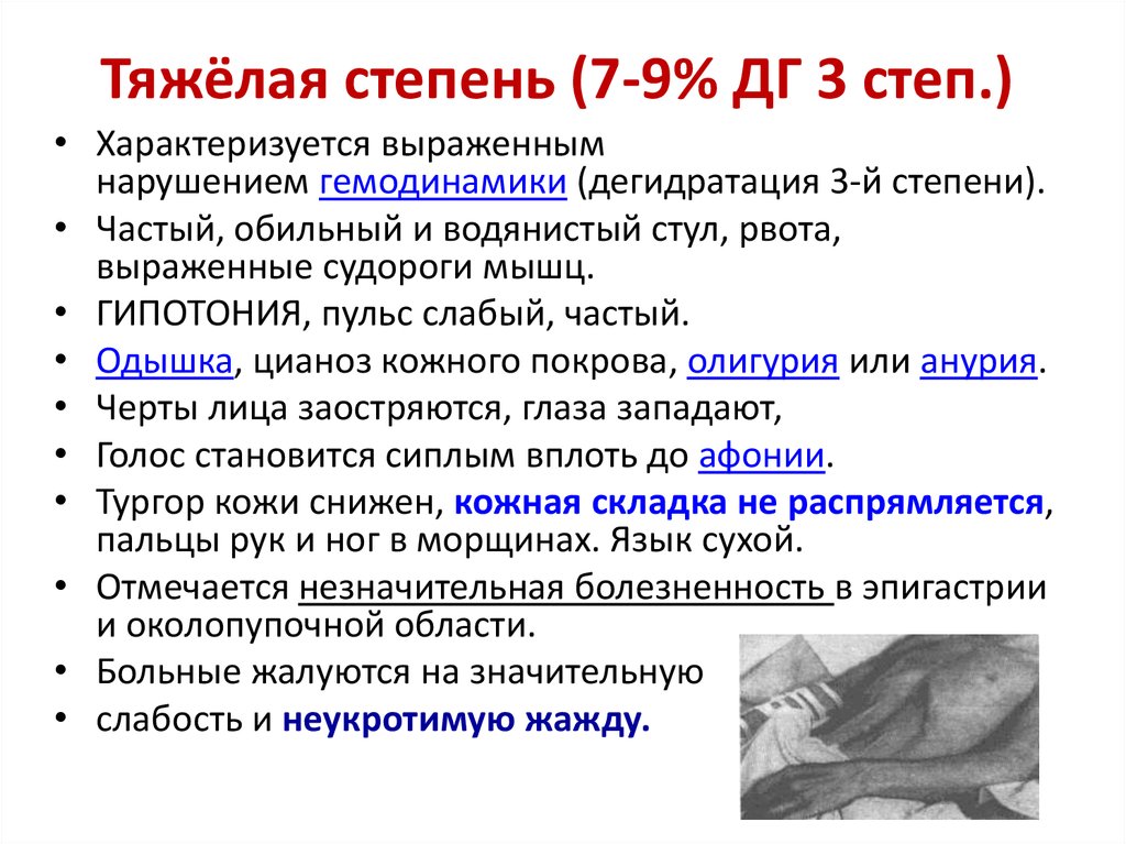 Холера история болезни. Холера степени обезвоживания. Тяжёлая степень дегидратации характеризуется. Холера стадии обезвоживания. Холера диагноз.