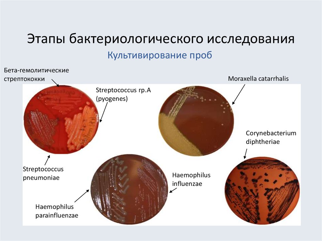 Бактериологический метод исследования