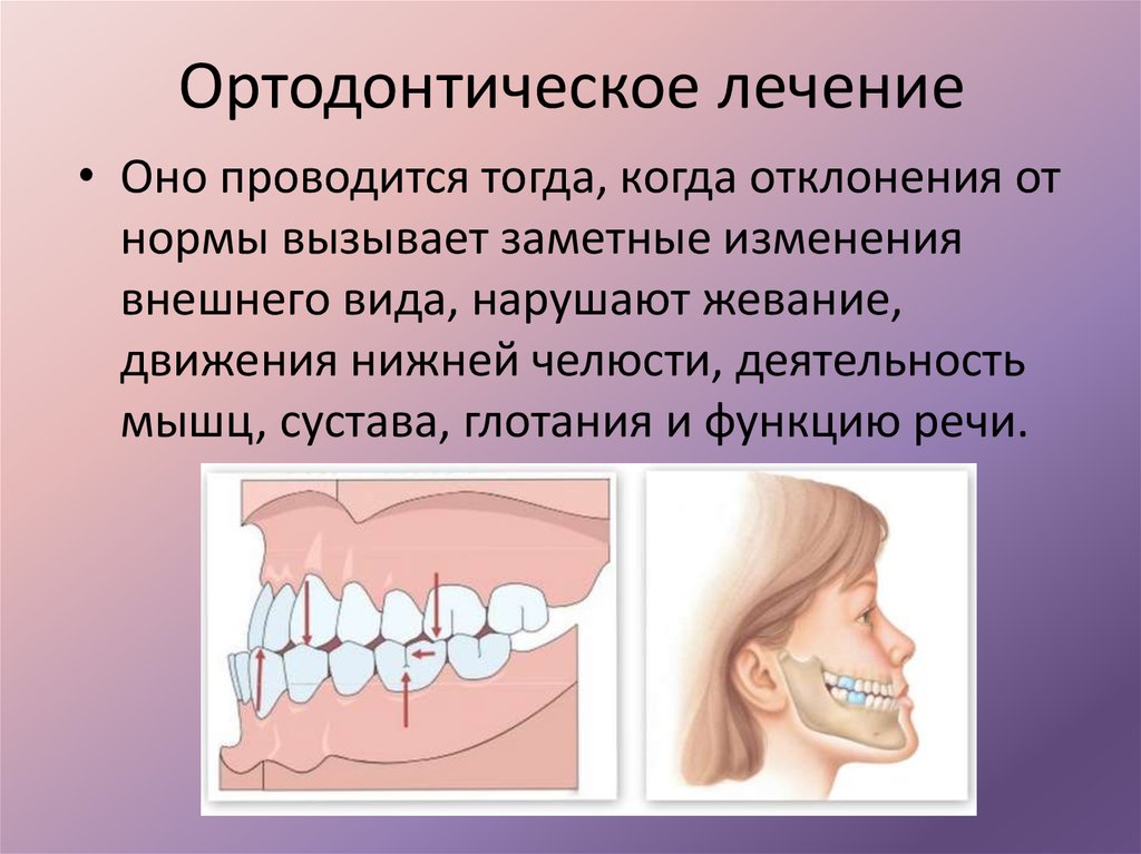 Презентация брекеты ортодонтия