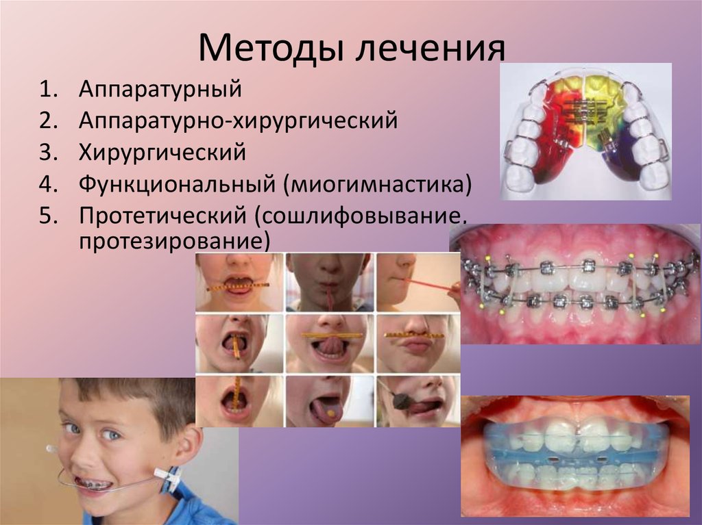 Хирургические методы в плане комплексного ортодонтического лечения