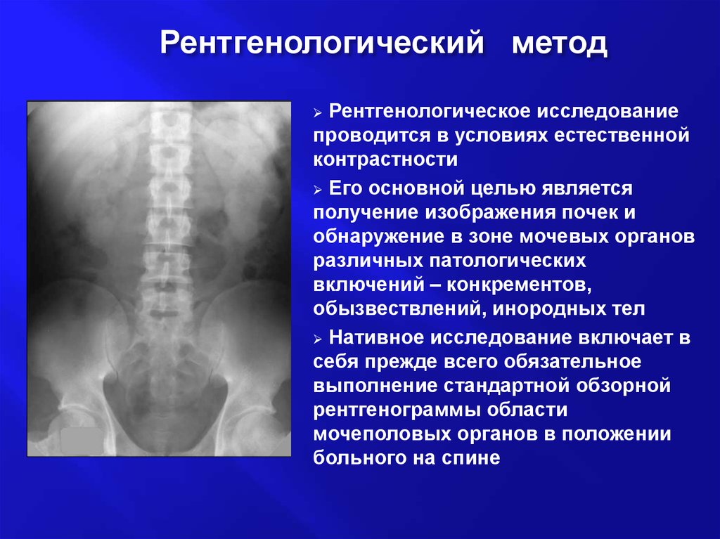 Методы рентгенологического исследования презентация